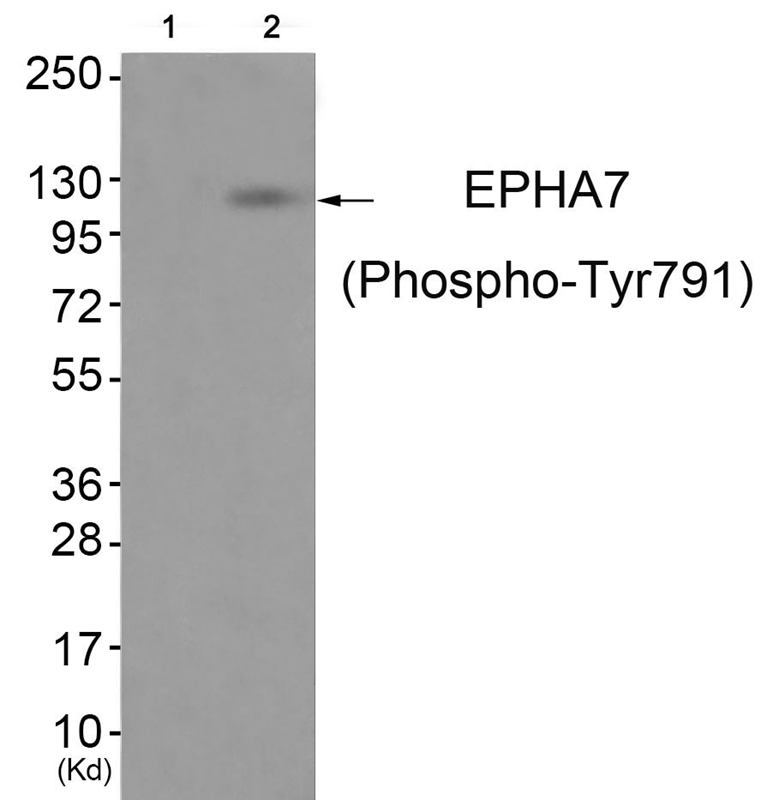 Rabbit Polyclonal Antibody to EPHA7 (Phospho-Tyr791)