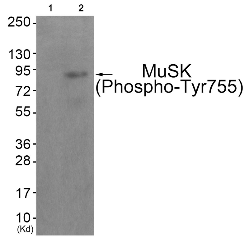 Rabbit Polyclonal Antibody to MuSK (Phospho-Tyr755)