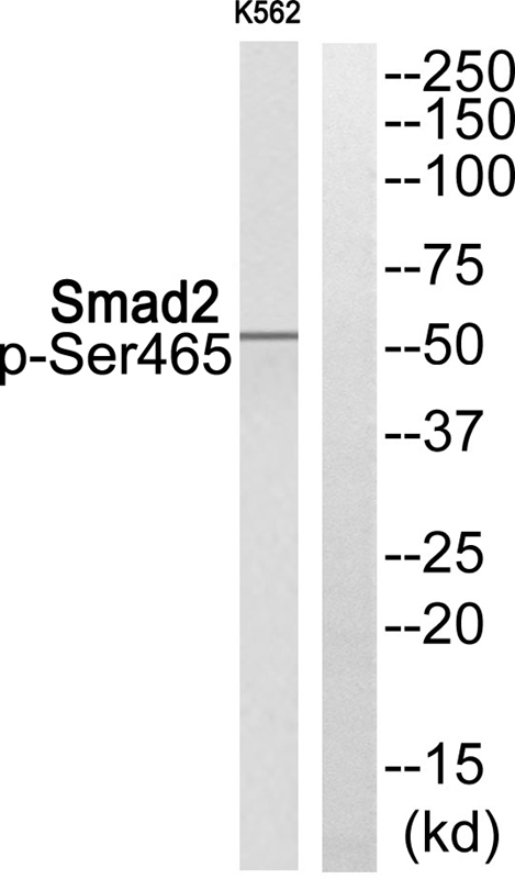 Rabbit Polyclonal Antibody to Smad2 (Phospho-Ser465)