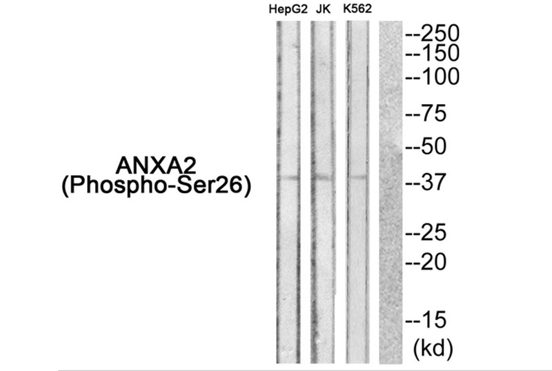 Rabbit Polyclonal Antibody to ANXA2 (Phospho-Ser26)