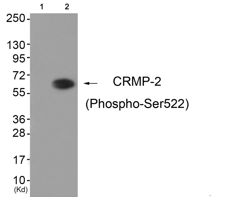 Rabbit Polyclonal Antibody to CRMP-2 (Phospho-Ser522)