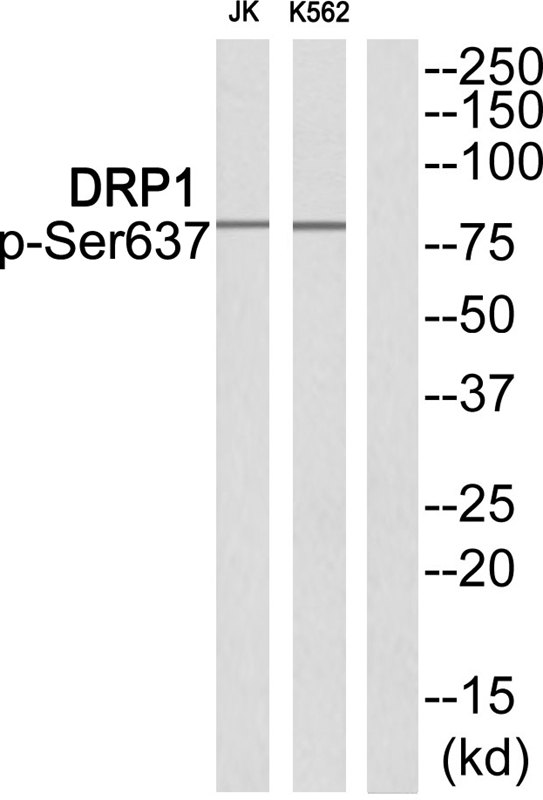 Rabbit Polyclonal Antibody to DRP1 (Phospho-Ser637)