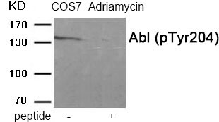 Rabbit Polyclonal Antibody to Abl (Phospho-Tyr204)