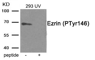 Rabbit Polyclonal Antibody to Ezrin (Phospho-Tyr146)
