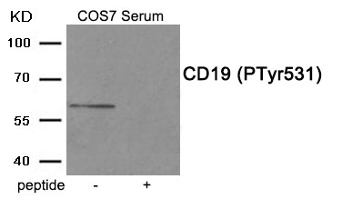 Rabbit Polyclonal Antibody to CD19 (Phospho-Tyr531)