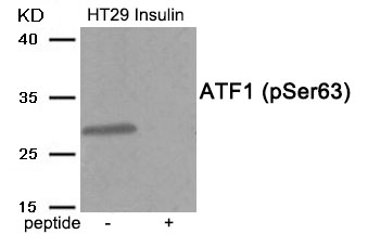 Rabbit Polyclonal Antibody to ATF1 (Phospho-Ser63)