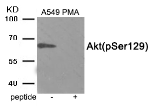 Rabbit Polyclonal Antibody to Akt (Phospho-Ser129)