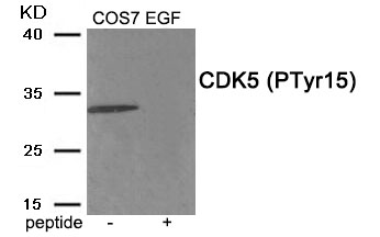 Rabbit Polyclonal Antibody to CDK5 (Phospho-Tyr15)