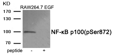 Rabbit Polyclonal Antibody to NF-κB p10(Phospho-Ser872)