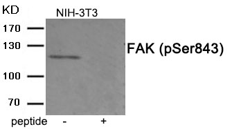 Rabbit Polyclonal Antibody to FAK (Phospho-Ser843)