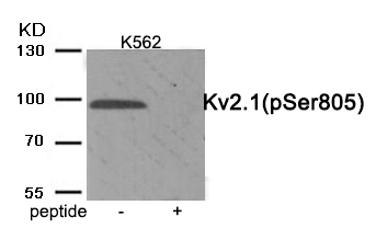 Rabbit Polyclonal Antibody to Kv2.1 (Phospho-Ser805)