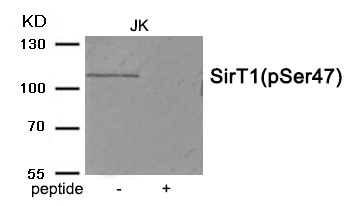 Rabbit Polyclonal Antibody to SirT1 (Phospho-Ser47)