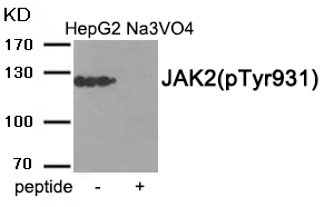 Rabbit Polyclonal Antibody to JAK2 (Phospho-Tyr931)