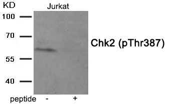 Rabbit Polyclonal Antibody to Chk2 (Phospho-Thr387)