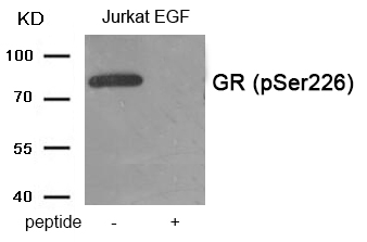 Rabbit Polyclonal Antibody to GR (Phospho-Ser226)