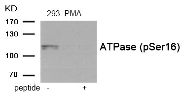 Rabbit Polyclonal Antibody to ATPase (Phospho-Ser16)