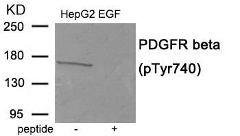 Rabbit Polyclonal Antibody to PDGFR beta (Phospho-Tyr740)