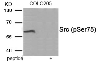 Rabbit Polyclonal Antibody to Src (Phospho-Ser75)