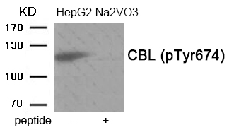 Rabbit Polyclonal Antibody to CBL (Phospho-Tyr674)