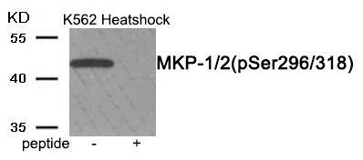 Rabbit Polyclonal Antibody to MKP-1/2 (Phospho-Ser296/318)