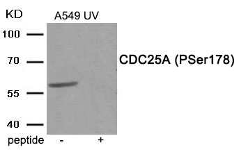 Rabbit Polyclonal Antibody to CDC25A (Phospho-Ser178)