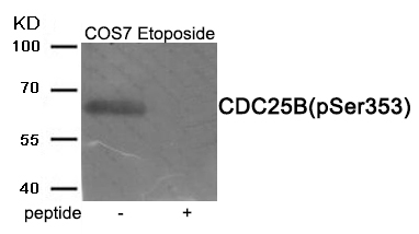 Rabbit Polyclonal Antibody to CDC25B (Phospho-Ser353)