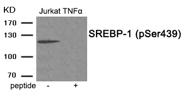 Rabbit Polyclonal Antibody to SREBP-1 (Phospho-Ser439)