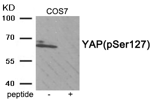 Rabbit Polyclonal Antibody to YAP (Phospho-Ser127)