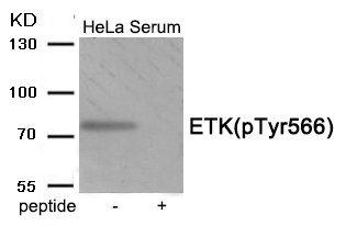 Rabbit Polyclonal Antibody to ETK (Phospho-Tyr566)