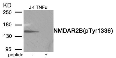 Rabbit Polyclonal Antibody to NMDAR2B (Phospho-Tyr1336)