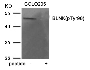 Rabbit Polyclonal Antibody to BLNK (Phospho-Tyr96)