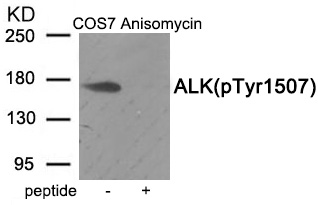 Rabbit Polyclonal Antibody to ALK (Phospho-Tyr1507)