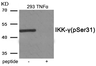 Rabbit Polyclonal Antibody to IKK- gamma (Phospho-Ser31)