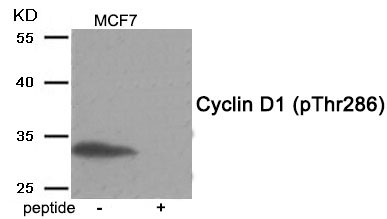 Rabbit Polyclonal Antibody to Cyclin D1 (Phospho-Thr286)