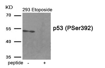 Rabbit Polyclonal Antibody to p53 (Phospho-Ser392)