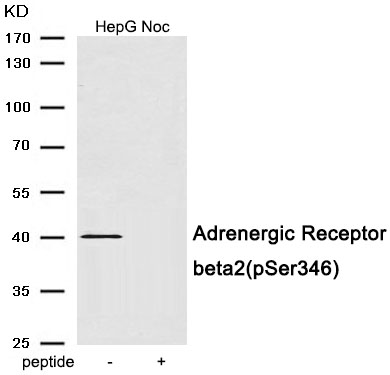 Rabbit Polyclonal Antibody to Adrenergic Receptor beta2 (Phospho-Ser346)