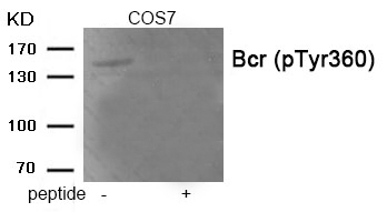 Rabbit Polyclonal Antibody to Bcr (Phospho-Tyr360)