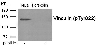 Rabbit Polyclonal Antibody to Vinculin (Phospho-Tyr822)