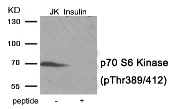 Rabbit Polyclonal Antibody to p7S6 Kinase (Phospho-Thr389/412)