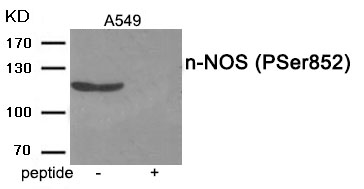 Rabbit Polyclonal Antibody to n-NOS (Phospho-Ser852)