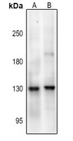 Rabbit Polyclonal Antibody to NMDAR1 (Phospho-Ser890)