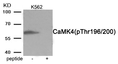 Rabbit Polyclonal Antibody to CaMK4 (Phospho-Thr200)