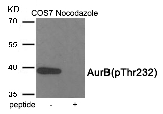 Rabbit Polyclonal Antibody to AurB (Phospho-Thr232)