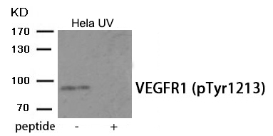 Rabbit Polyclonal Antibody to VEGFR1 (Phospho-Tyr1213)
