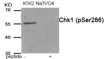 Rabbit Polyclonal Antibody to Chk1 (Phospho-Ser286)
