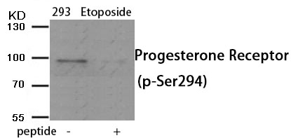 Rabbit Polyclonal Antibody to Progesterone Receptor (Phospho-Ser294)