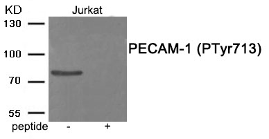 Rabbit Polyclonal Antibody to PECAM-1 (Phospho-Tyr713)