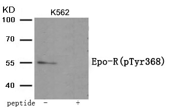 Rabbit Polyclonal Antibody to Epo-R (Phospho-Tyr368)