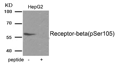 Rabbit Polyclonal Antibody to Estrogen Receptor- beta (Phospho-Ser105)