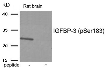 Rabbit Polyclonal Antibody to IGFBP-3 (Phospho-Ser183)